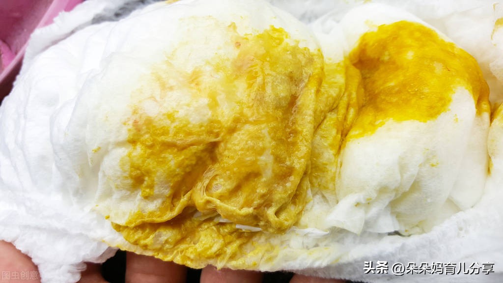 便便看出健康问题,15种便便看出宝宝健康