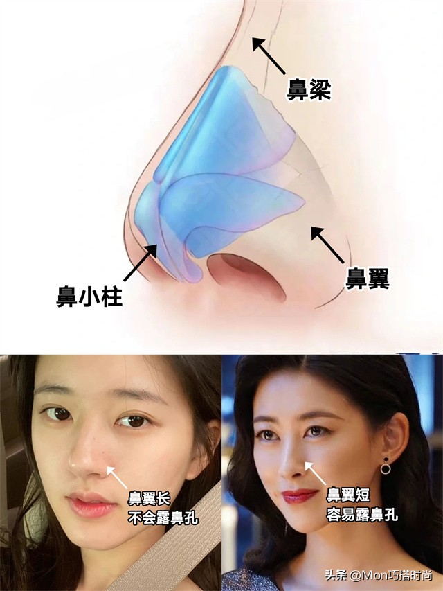 鼻子显凶显老怎么办,鼻子塌陷是不是显得人难看