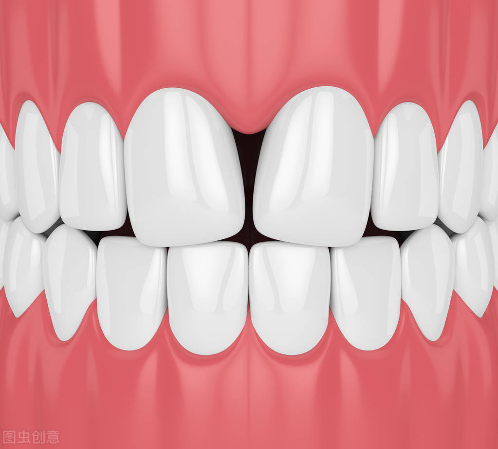 牙齿出现黑三角怎么办能恢复,牙齿严重黑三角怎么补救