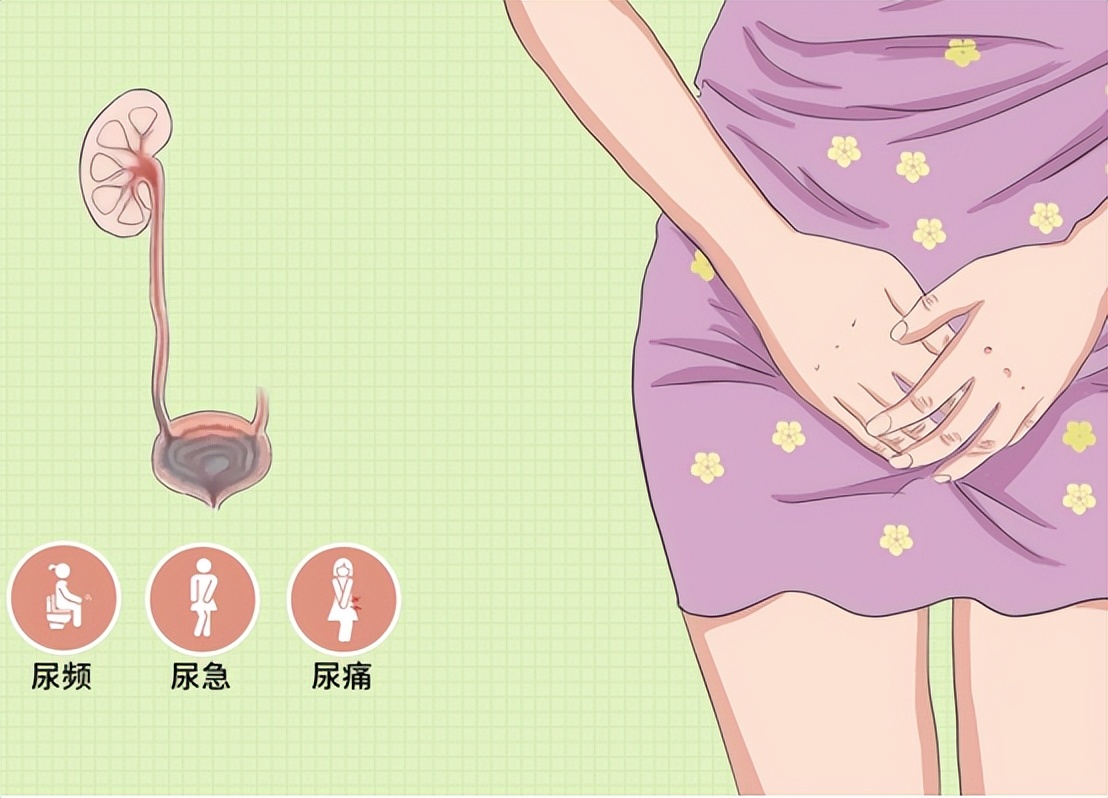 尿路感染最常见的致病菌有哪些,发生尿路感染最常见的感染途径是