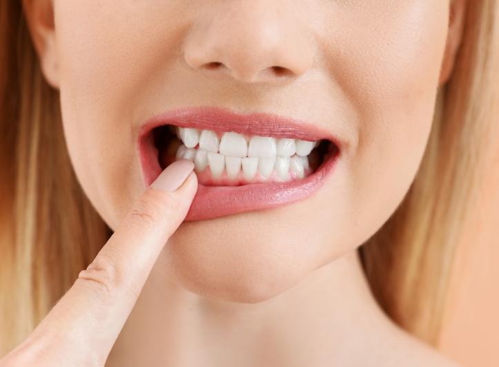 牙根纵裂怎么治疗最好,牙根病变的最好治疗方案