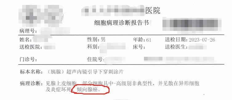 如何最终确诊?发现胰腺占位:穿刺病理的重要性