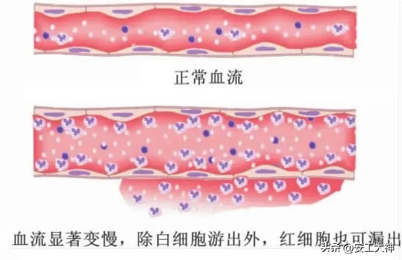 疫情正确的自我保护方式,疫情反弹注意保护好自我