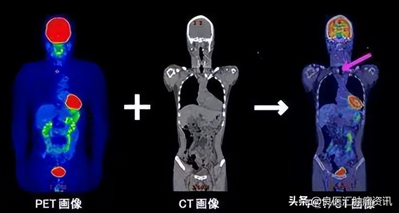 代糖真的致癌吗,代糖真的不会让人长胖吗