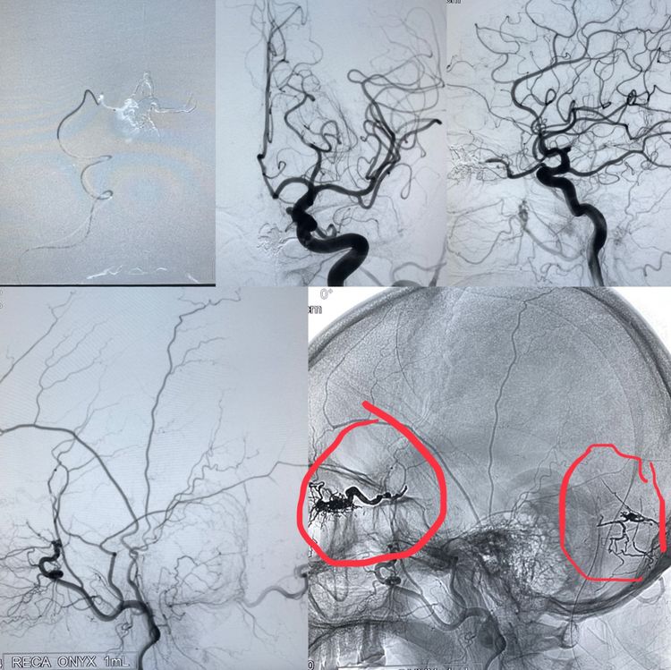 一个值得唠叨几句的病例
