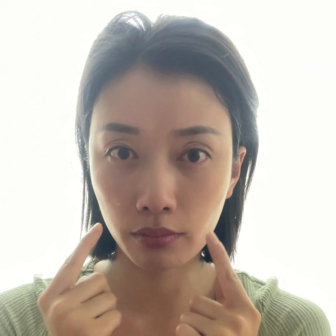 眼肌下垂怎么改善,改善眼部肌肉下垂让眼睛变有神