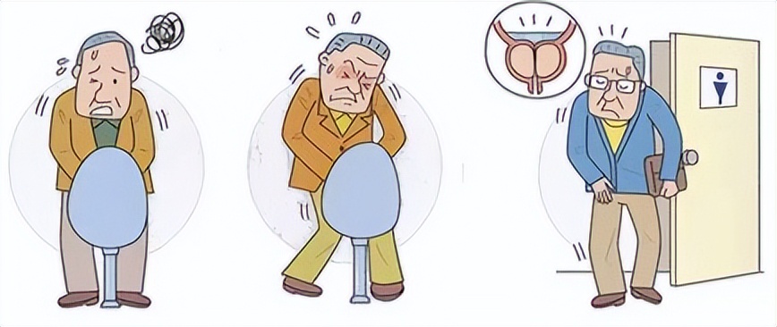 慢性前列腺炎怎样辨证分类,慢性前列腺炎治愈的标准是