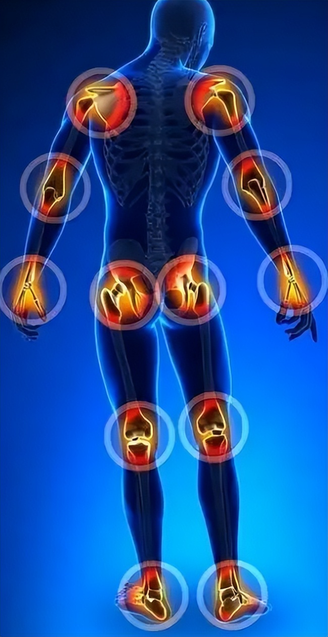 类风湿性关节炎日常应该注意事项,类风湿性关节炎睡眠也不好