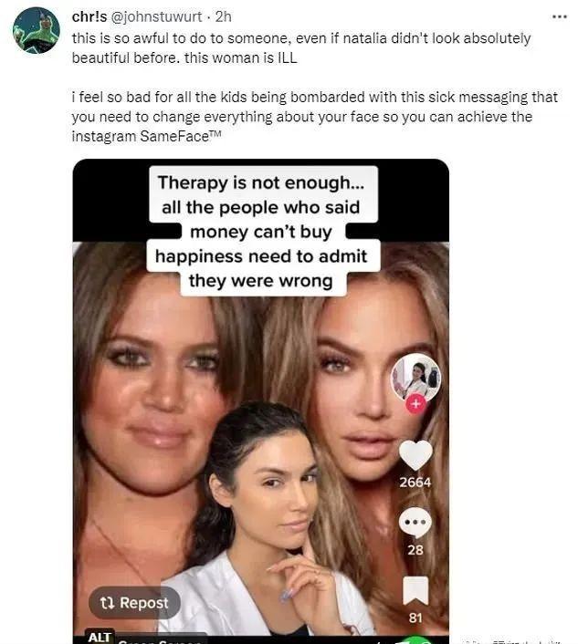 为什么都很讨厌网红脸,是不是所有人都不喜欢脸红