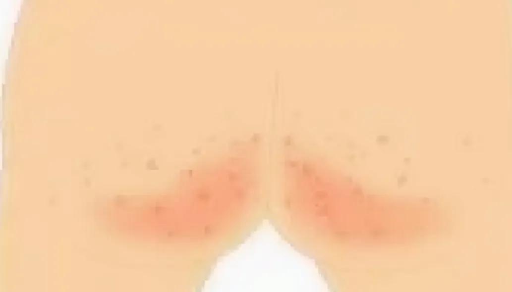 你信不信，这五种皮肤外用药你都用错过