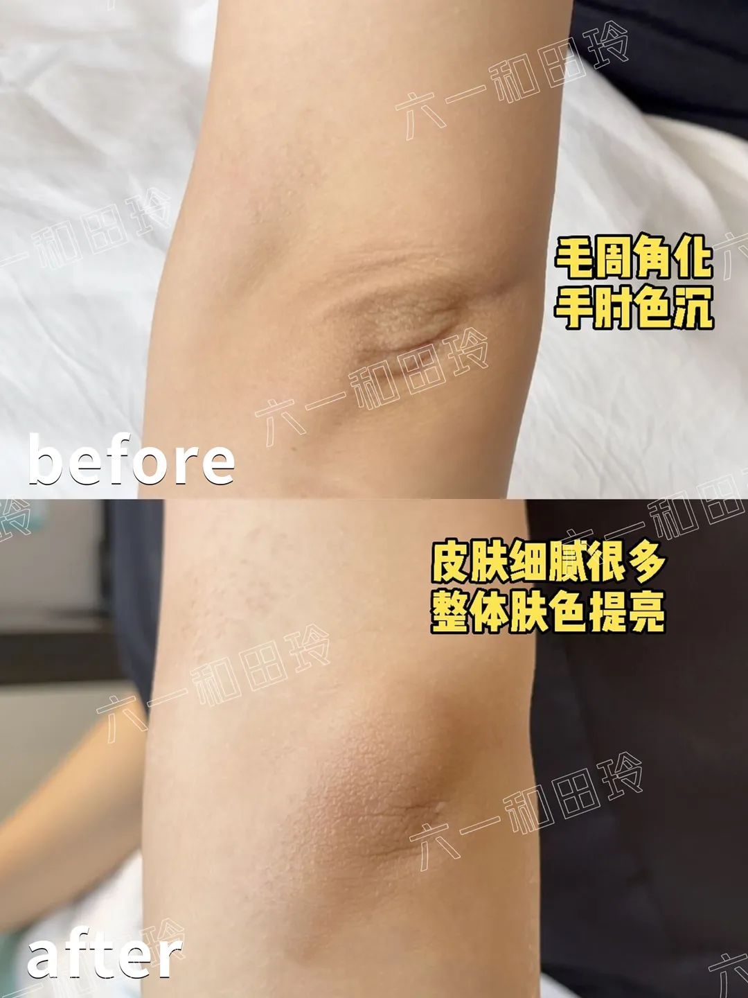 各种酸的用途及使用方法,各种酸的种类及不同的功效