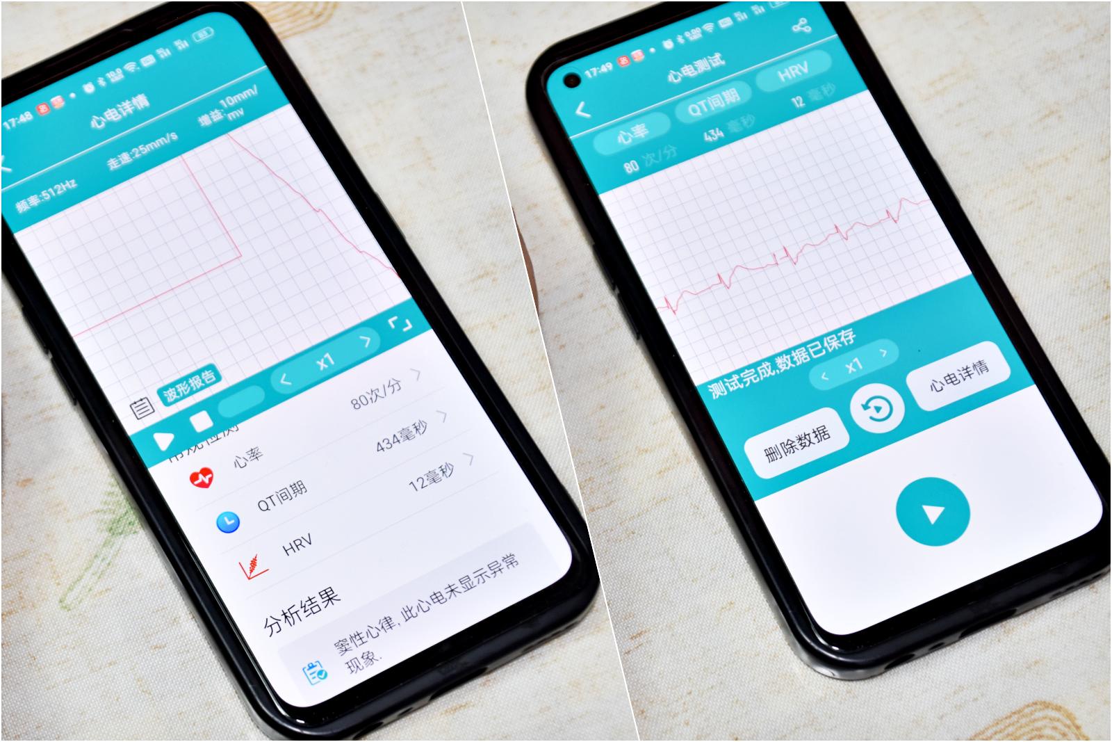 DidoF50SPro智能大屏血压手环,didof50s血糖手环