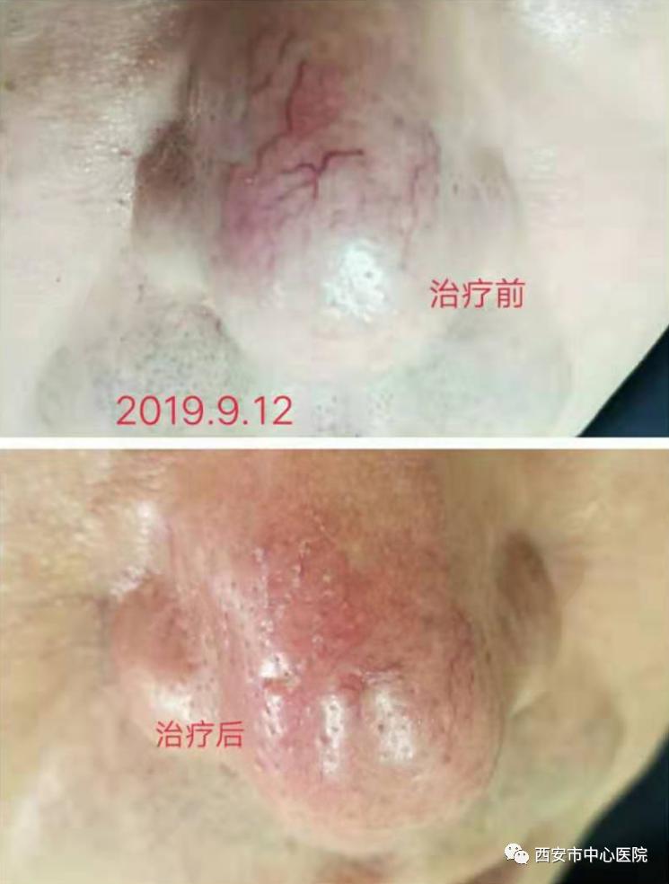 想美吗！找针灸！