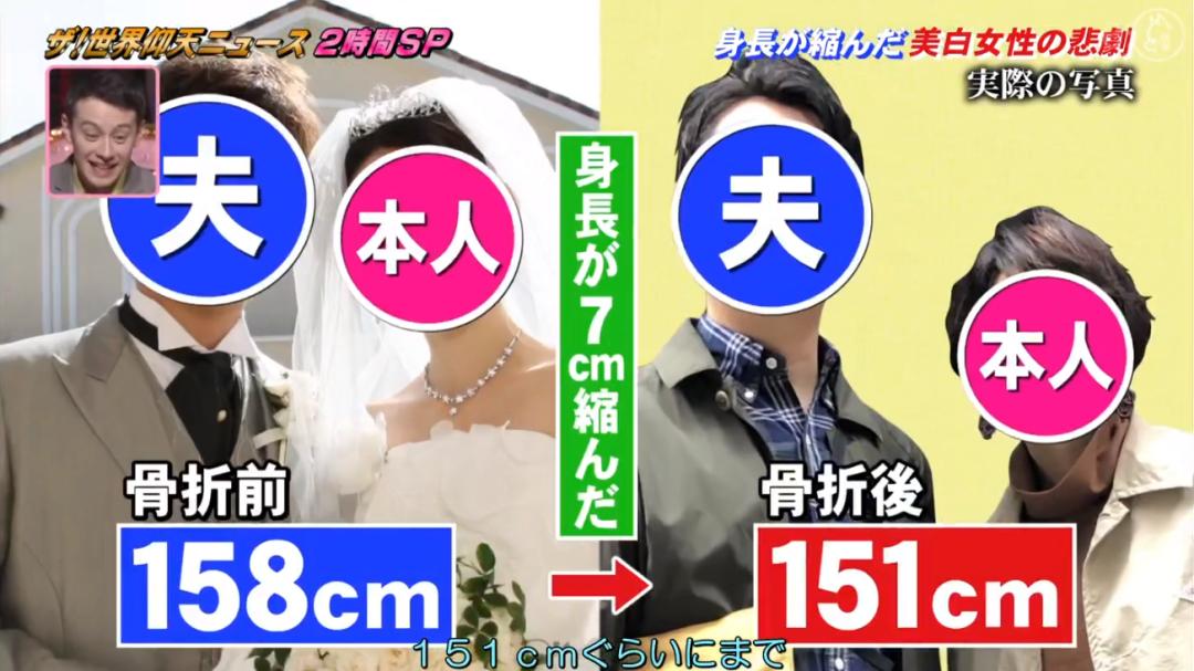 日本漂亮小姐姐不想被晒黑，每天全副武装！2年后身高竟缩水7cm…