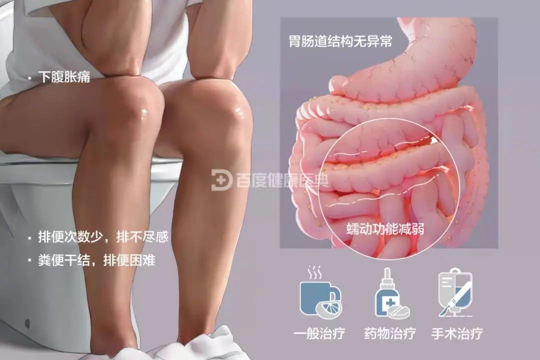 功能性便秘的原因和治疗方法,中医对功能性便秘有办法吗