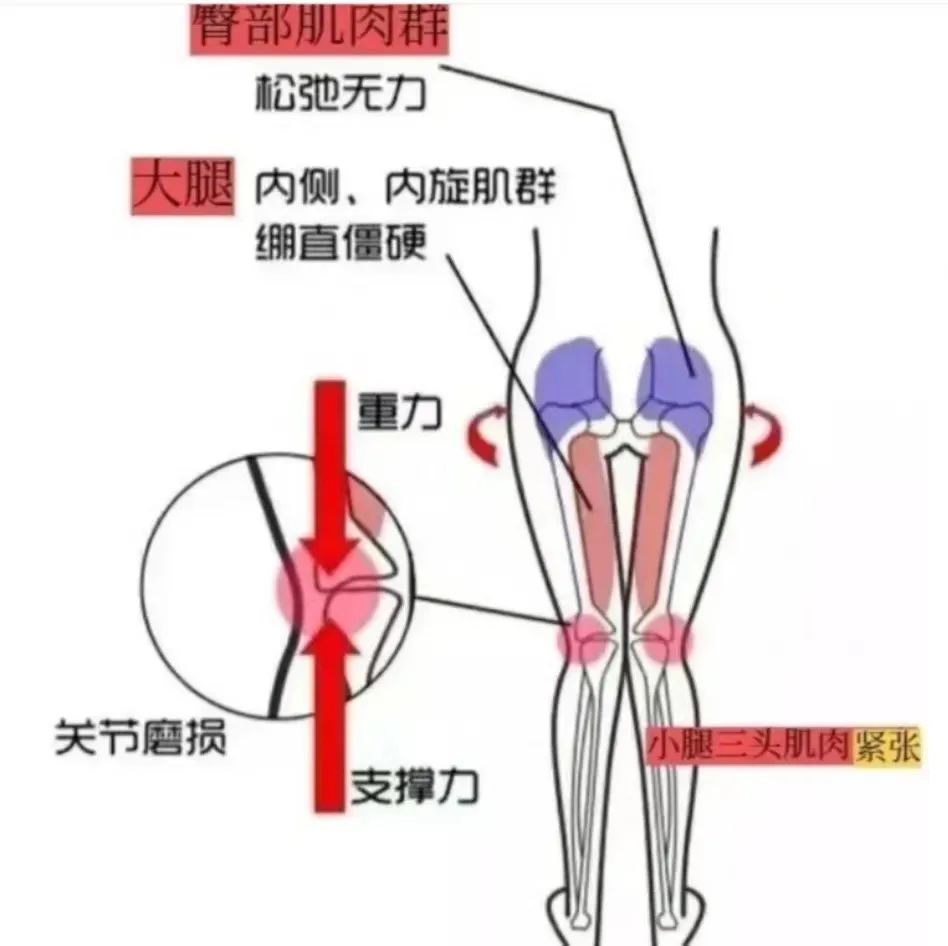 为什么男生的腿都要比女生细,为什么男生都喜欢腿细的女生