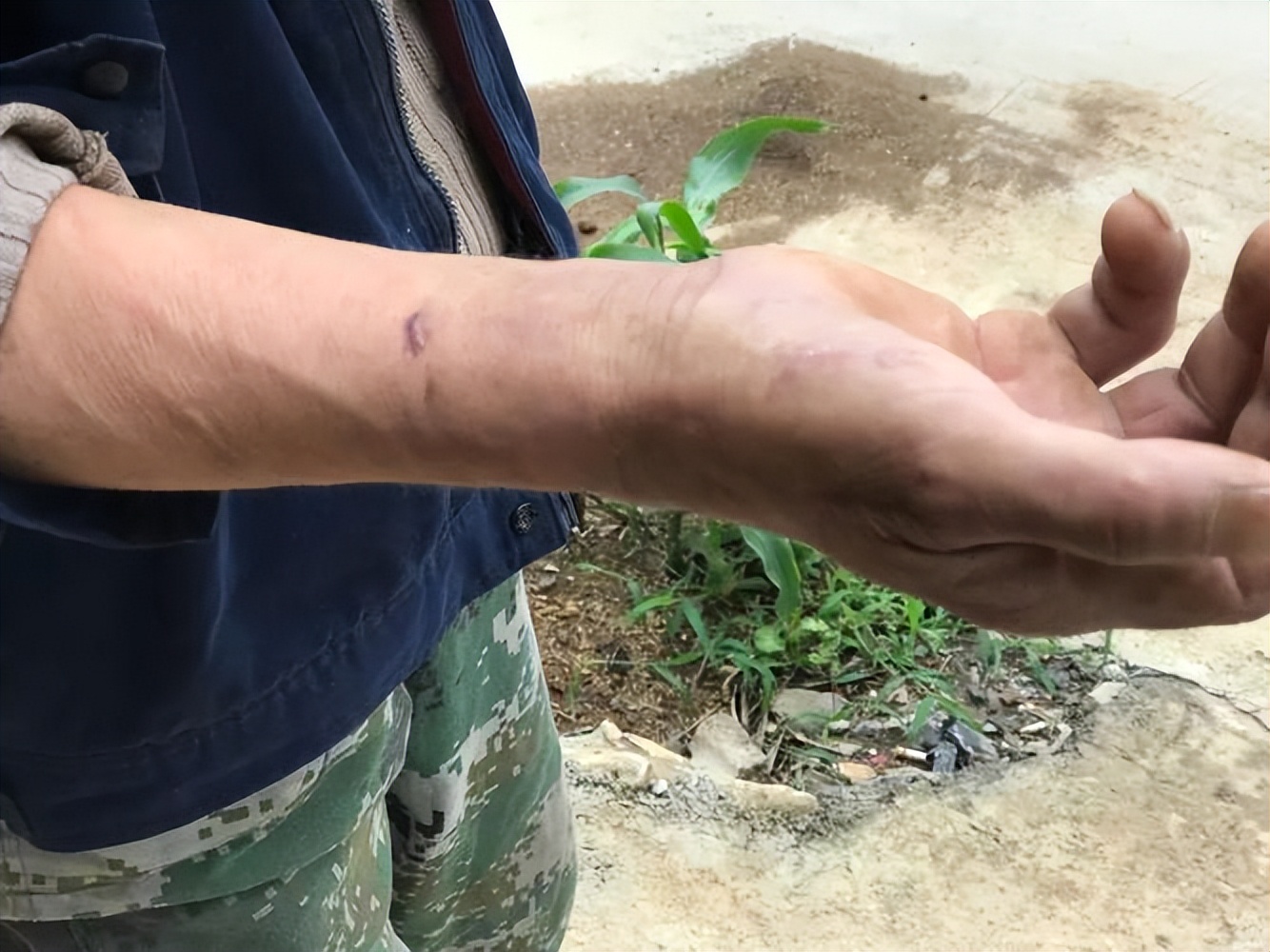 提高免疫力最好最实用的药是什么,提高免疫力的药物哪个最好最快