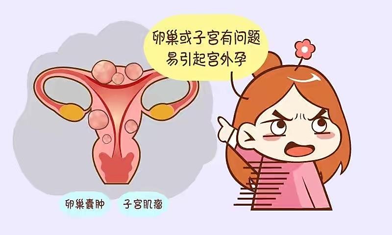 女性为什么容易长子宫肌瘤呢？医生：尽量避免3个行为，别忽视