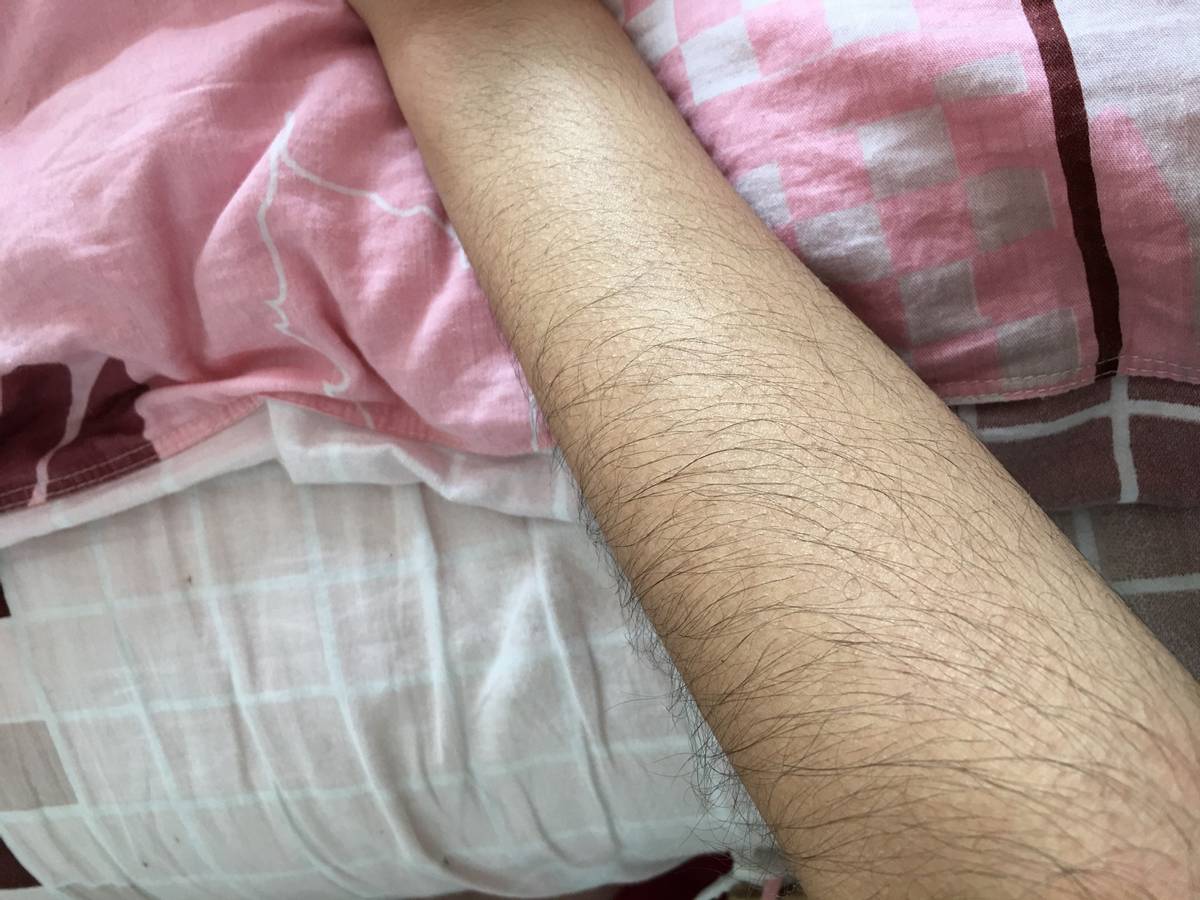 长在隐秘处,“肛毛”真的多余吗?为啥最好不要刮?