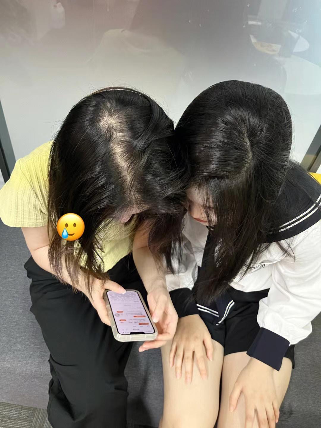 哪些因素会导致秃发,怎样可以停止斑秃继续掉发