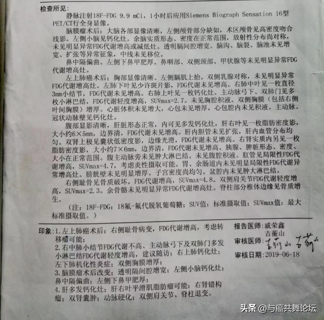 陪妻子抗癌多年视频,查出早期肺癌算是不幸中的幸运