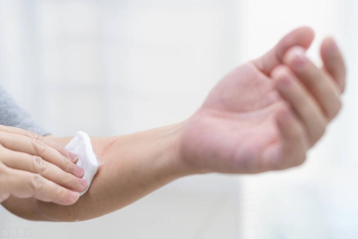 伤口迟迟不恢复是什么原因,伤口留疤原因及解决方法