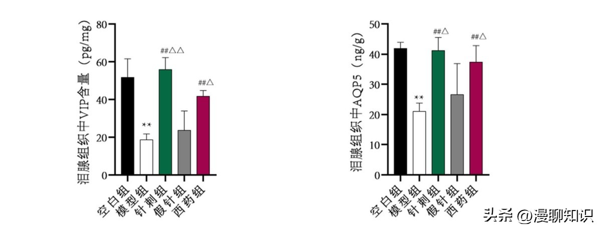 干眼就是干燥综合症吗,眼干涩视物模糊得了干眼怎么办