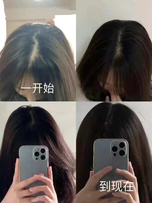 老国货洗发水防脱生发,洗发水测评真实推荐防脱去屑止痒