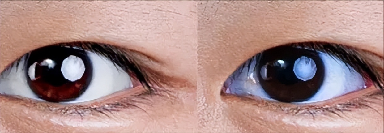 ps磨皮插件dr5能处理疤痕吗,dr5磨皮插件哪个版本最好