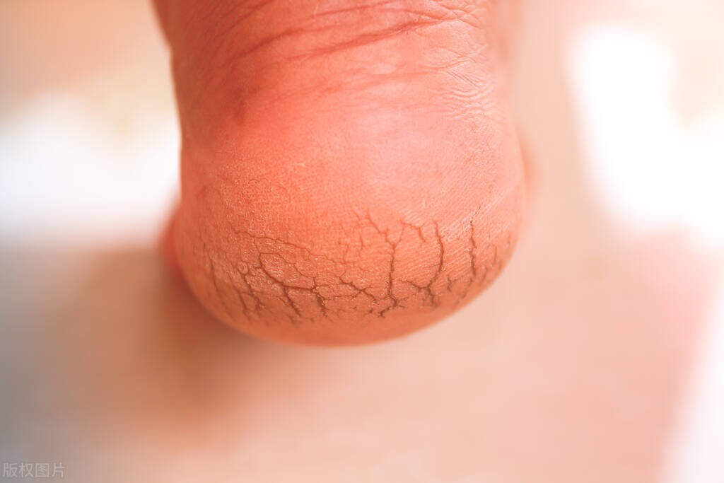 大便完用水洗好还是纸好,大便用水洗屁屁好不好