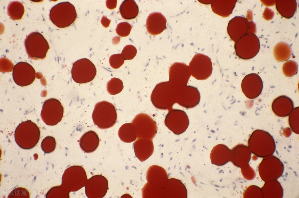 结节和脂肪瘤的病根是什么,脂肪瘤切了怎么还长