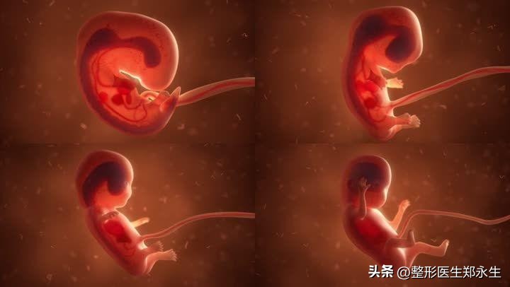 为什么会导致小耳畸形,大小耳畸形有遗传吗