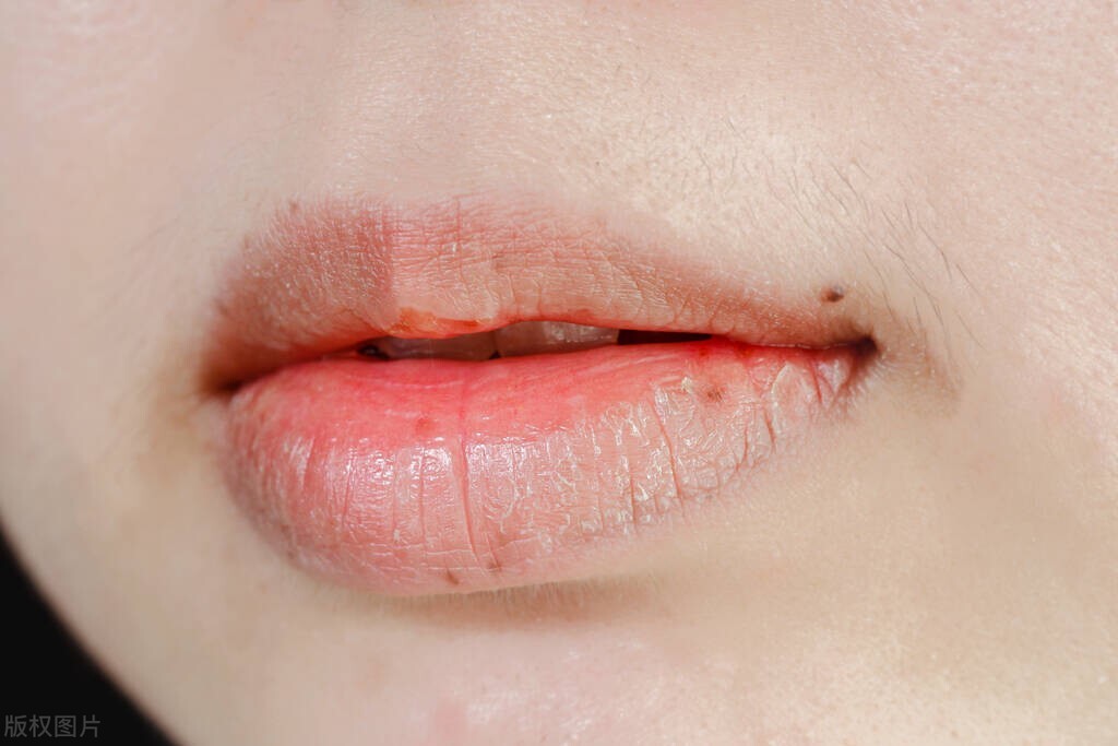 睡醒嘴巴特别干缺水怎么办,晚上嘴发干要喝水什么原因