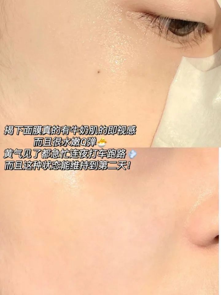 祛痘面膜淡化痘印测评,祛痘淡斑面膜测评