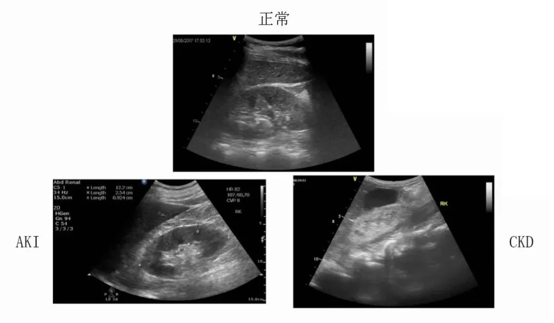 「肾脏病学」刘丽霞教授：肾脏血流动力学监测实施路径
