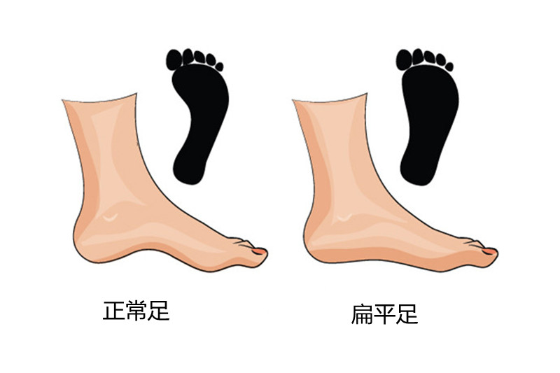 腰酸腿疼是因为什么,出现腰酸腿疼是什么原因