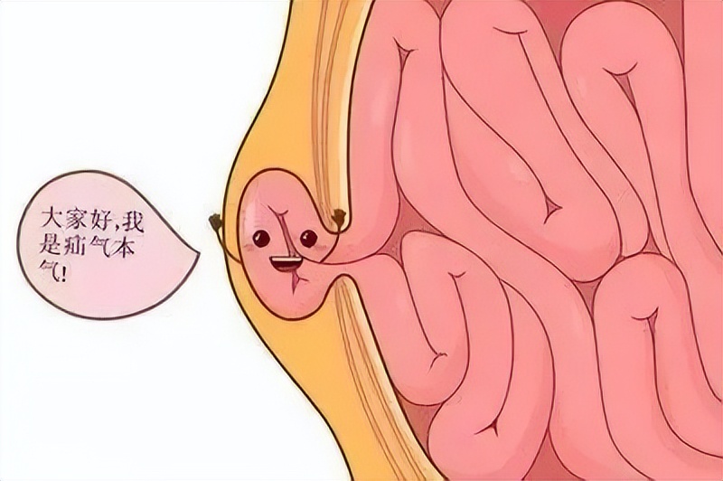 膈疝和疝气是不是一种病,疝气在小肚子上是什么疝