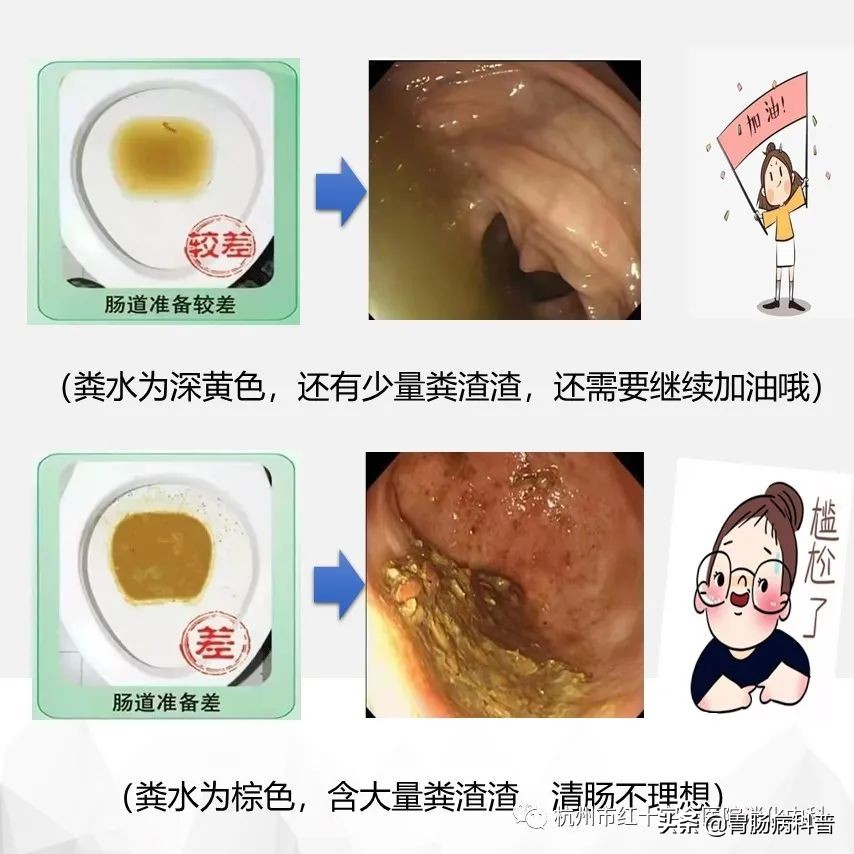 省人民医院胃肠镜检查须知,肠镜胃镜检查须知