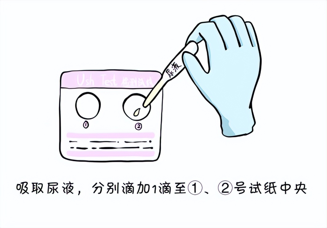 怀孕查出hpv31,怀孕hpv阳性会影响胎儿吗