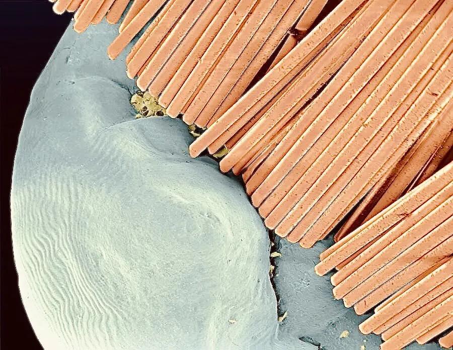 手指在显微镜下太恐怖了,显微镜下的恐怖世界蝎子