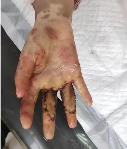 6岁被继母虐待女童事件完整版,六岁女童惨遭继母虐待