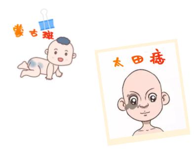 长毛痣怎么治最有效果,嘴角痣长毛凸起能点吗