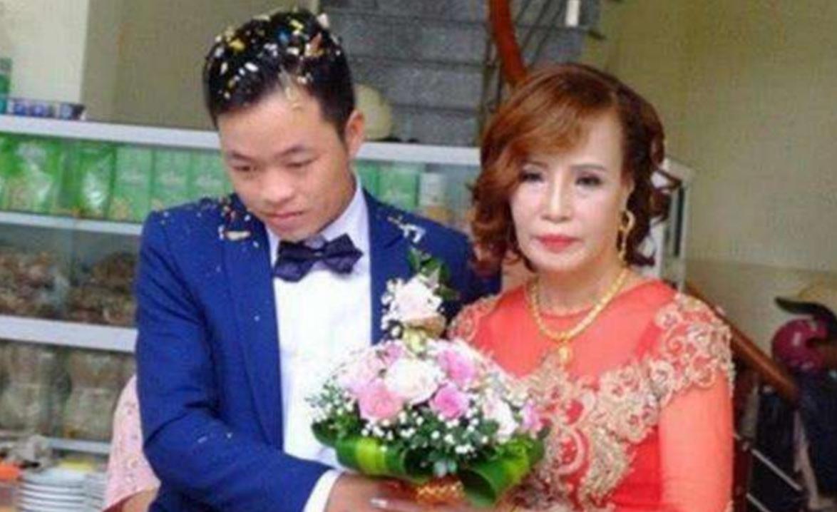 越南62岁老妇嫁给27岁小伙，还为他多次整容，如今却肿得不能看