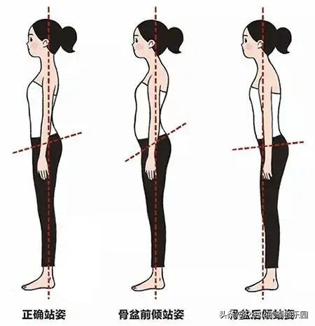 袁泉短发怎么减肥,袁泉瘦