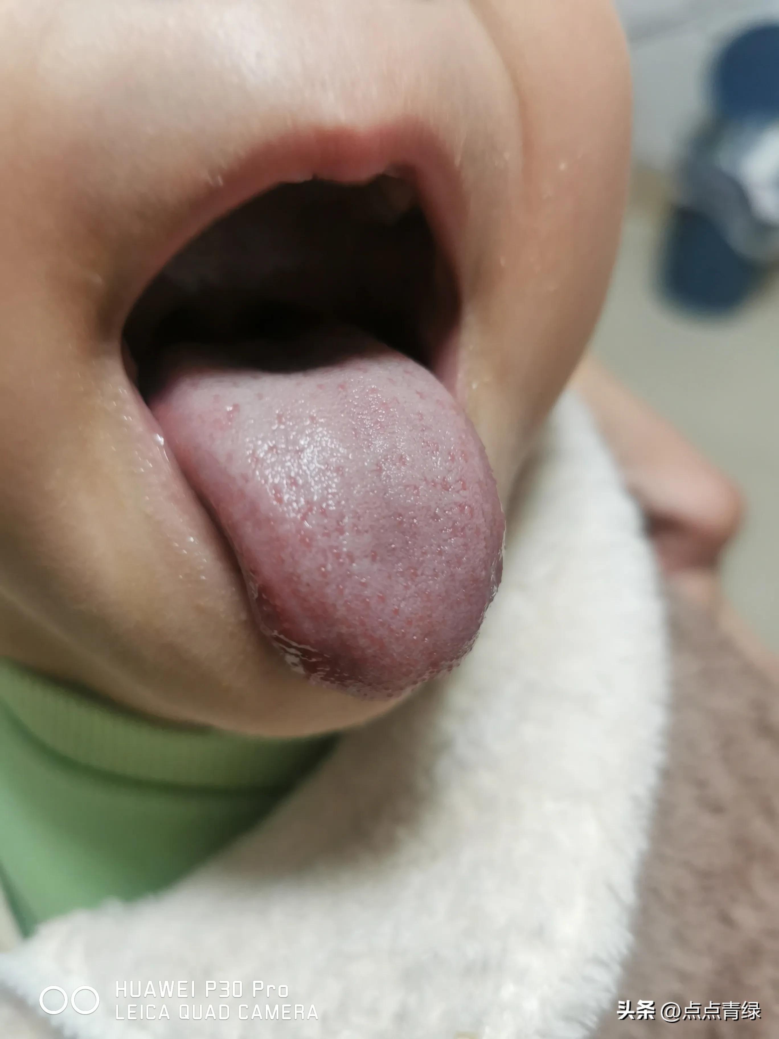 一边是生病的父母一边是年幼的孩子，我该选择照顾谁？