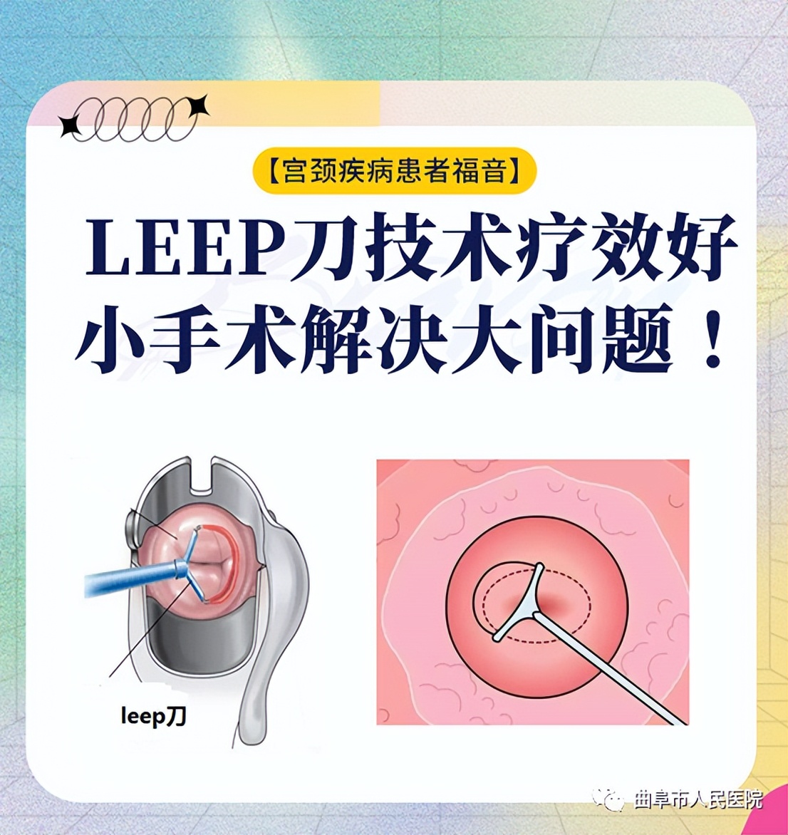 宫颈物理治疗leep刀,宫颈leep刀后病理显示慢性宫颈炎