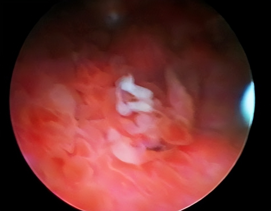 央视曝光市场“夺命毒衣服”，致癌物超标20多倍！可别再乱买了