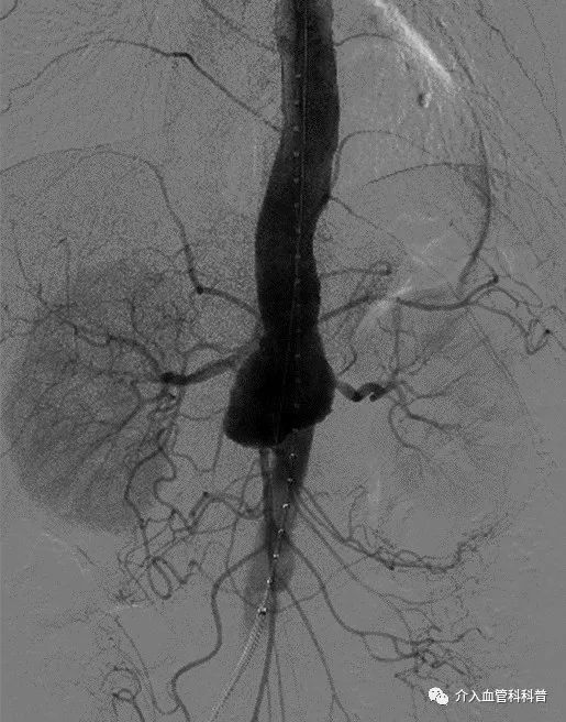 南昌二附院血管外科专家,南昌大学第二附属医院周卫