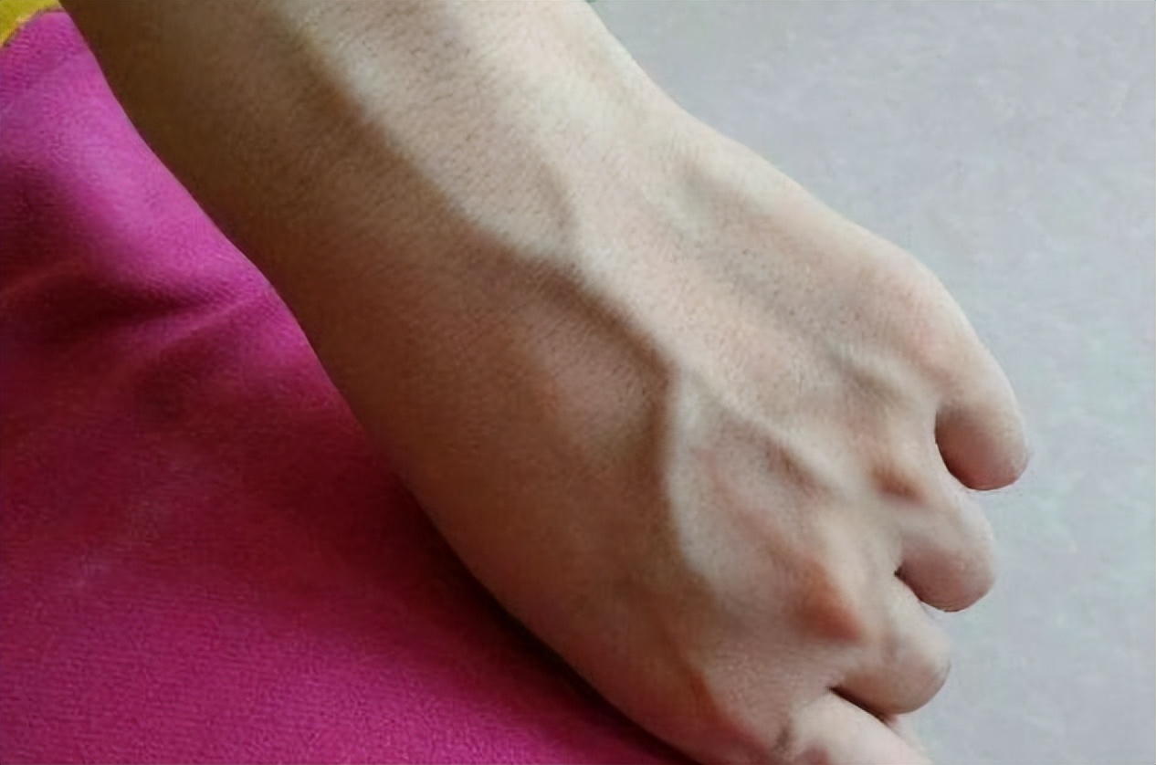 人手臂上的青筋看得出吗,手臂爆青筋是天生的吗