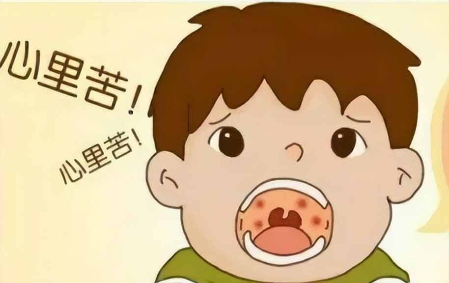 儿童急性扁桃体炎症状及治疗,急性扁桃体炎的主要并发症是什么